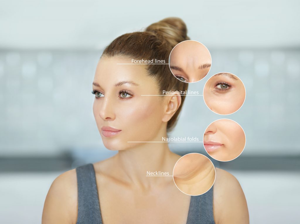 Anti-wrinkle Injections Richmond