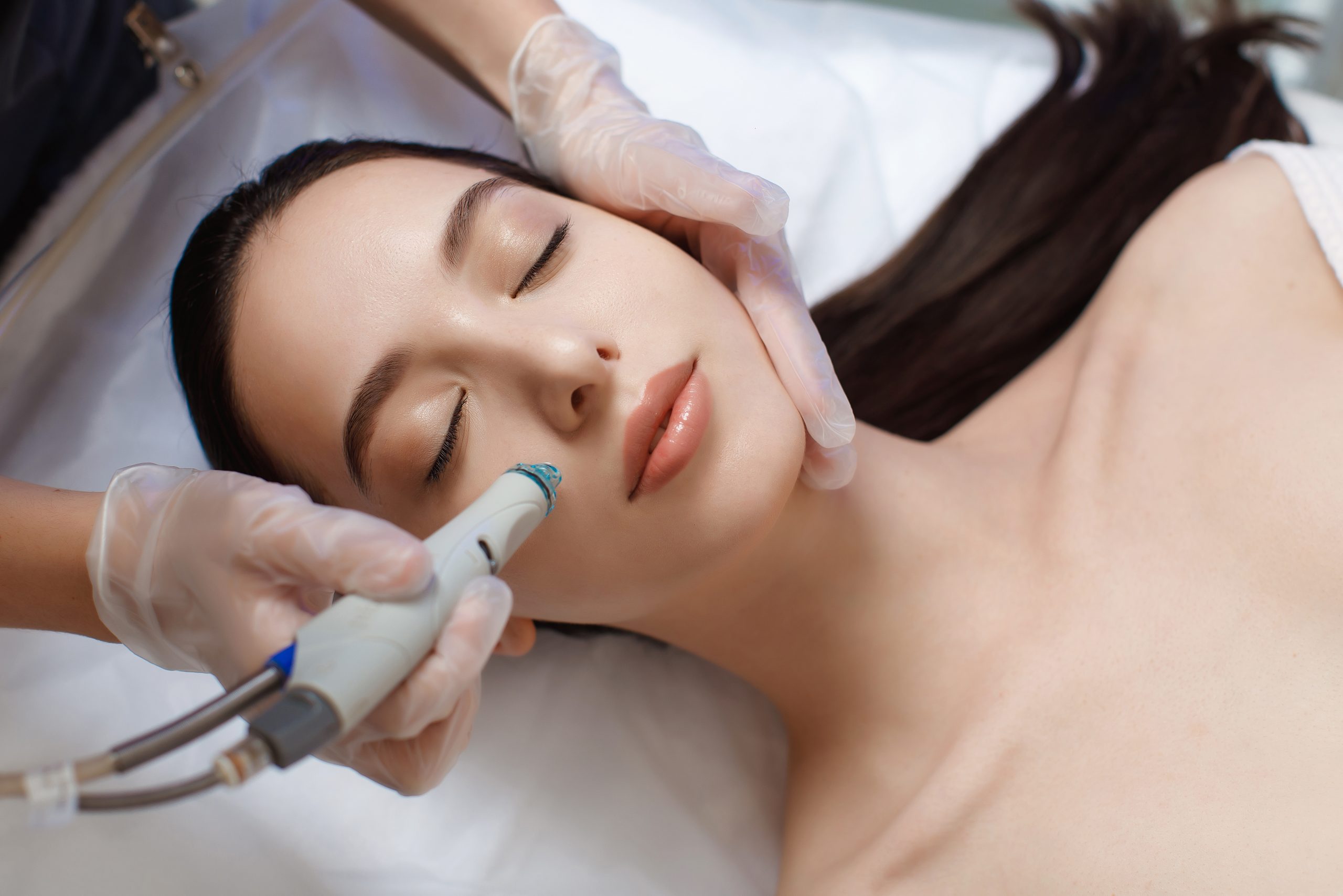 Female Hydrafacial Rejuvenation in Richmond